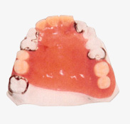 従来の義歯の写真